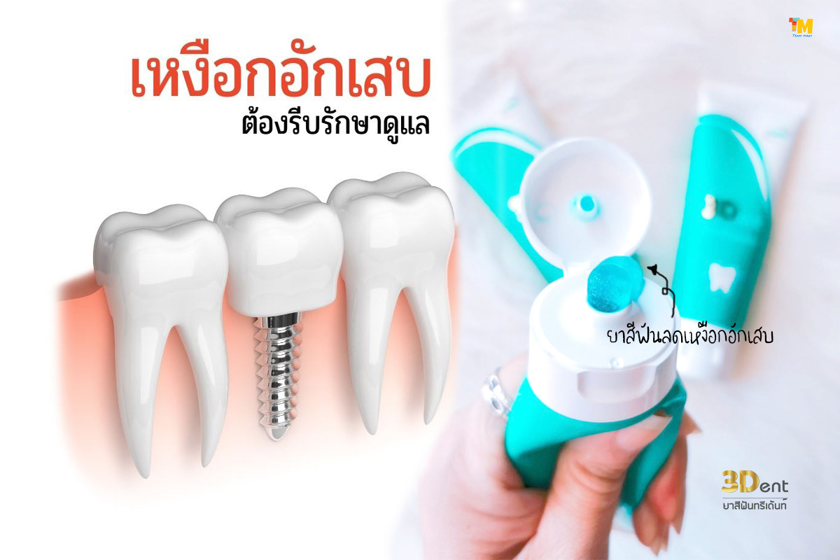 ยาสีฟันรักษารากฟัน